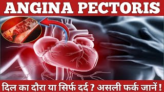 ❤️‍🩹angina pectoris in hindi  seene mein dard kyon hota hai   chest pain ho to kya karen  1mg [upl. by Scevor]