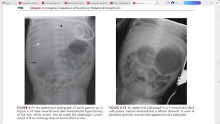 EMERGENCY RADIOLOGY REQUISITES [upl. by Attennaj]