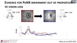 Human Measurements and Biomarkers of Optic Neuropathies  Ophthalmic adults Heather Moss [upl. by Elyk]