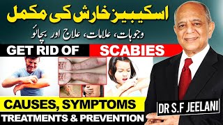 Scabies  Causes Symptoms Treatments amp Preventionखुजलीاسکیبیز کی خارش سے مکمل نجات drjeelani [upl. by Retnyw966]