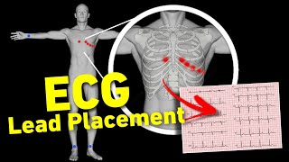 ECG lead placement MADE EASY  12 lead ECG placement  How to perform ECG • Daily Cardiology [upl. by Juieta370]