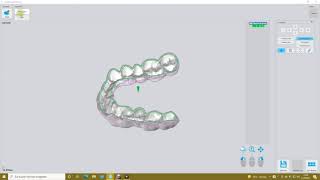 Tutorial  Arbeitsvorbereitung Aufbissschiene DS CAM 42 [upl. by Roice353]