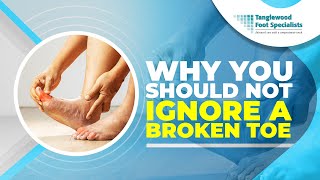 Why You Should Not Ignore a Broken Toe [upl. by Riddle609]