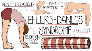 Ehlers Danlos Syndrome Explained Clearly [upl. by Aifas298]