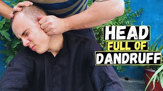 Dandruff Head Heavy Oily Head Massage ASMR To Relief Headache Neck amp Head Massage [upl. by Ataynik957]