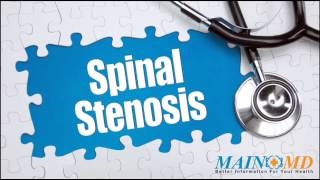 Spinal Stenosis ¦ Treatment and Symptoms [upl. by Whorton667]