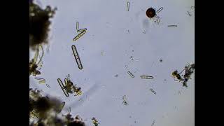 Some Diatoms in a Puddle [upl. by Orella]