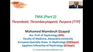 Thrombotic Thrombocytopenic Purpura TTP TMA part 2 [upl. by Elleimac249]