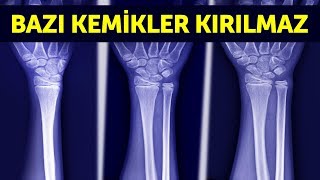 Muhtemelen Sahip Olmadığınız 12 İnanılmaz Nadir Özellik [upl. by Ahsinav]