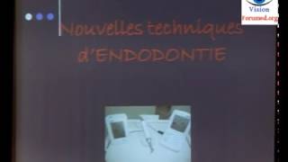 Traitement endodontique technique dobturation dentaire [upl. by Sylvan]