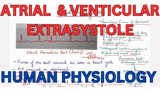 ATRIAL extrasystole Ventricular Extrasystole compensatory pause CVS [upl. by Arther641]