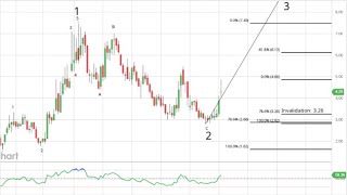 Stock Market News Why Institutions Bought Unusual Options On These UnderTheRadar BONUS STOCKS [upl. by Enovahs]