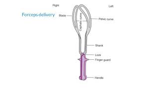 Forceps delivery indications Contraindication and re quest [upl. by Cherianne]