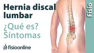 Hernia discal o de disco lumbar  Qué es causas síntomas y tratamiento [upl. by Vivianna]