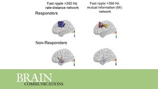 Graph theoretical measures of fast ripples support the epileptic network hypothesis [upl. by Favata]