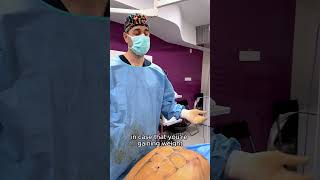 Dr Levy  Explains 4K HighDefinition Abdominal Liposuction made with VASER PRO [upl. by Anelleh754]