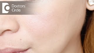 How to remove white spots on face  Dr Rashmi Ravindra [upl. by Keil]