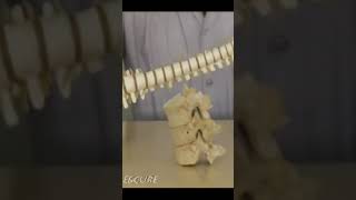 what is disc disc use intervertebral disc disc injury disc bulge tamil disc prolapse tamil [upl. by Horatio]