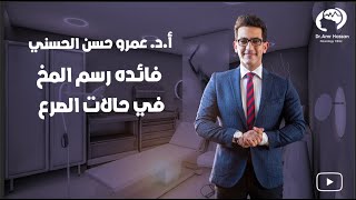 فائده رسم المخ في حالات الصرعأدعمرو حسن الحسني أستاذ المخ والأعصاب [upl. by Dopp]