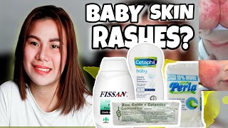 TREATMENT FOR BABY SKIN RASHES AND ITCHING  CALMOSEPTINECETAPHIL amp FISSAN REVIEW [upl. by Kered]