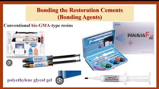 Bonding Steps of ResinBonded FDP بالعربي [upl. by Codie]