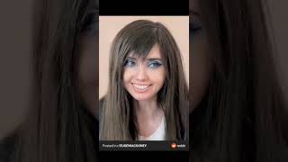 Eugenia Cooney Weight Loss Comparison Photos😱 [upl. by Kos542]