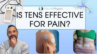 Does TENS Actually Work  Expert Physio Review [upl. by Auod]