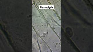 Plasmolysis and Osmosis biology gcse [upl. by Vigen735]