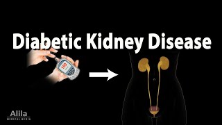 Diabetic Kidney Disease Animation [upl. by Daukas]