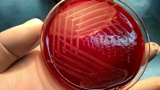 Colony morphology of bacteria  beta haemolytic streptococci  S pyogenes S agalactiae [upl. by Imled]