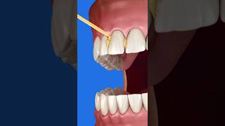 Deberías usar palillos de madera 🦷 curiosidades [upl. by Nimad]