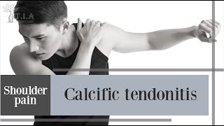 What is calcific tendinitis [upl. by Oiracam99]