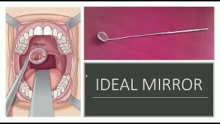 INDIRECT LARYNGOSCOPY MIRROR IN ENT [upl. by Henrietta]