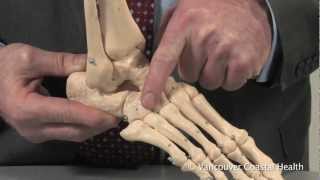 Osteoarthritis of the Midfoot [upl. by Denver]