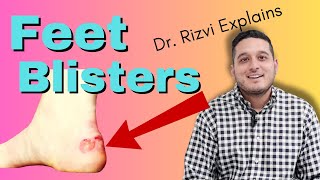 Feet Blisters Causes and Treatment  Dr Rizvi Explains [upl. by Weatherby]