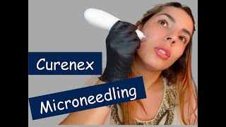 Micronnedling Curenex le combo Parfait pour une peau éclatante élimine les taches BrunoDermalFiller [upl. by Gerianna]