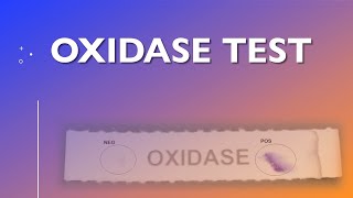 Oxidase Test [upl. by Conlen]