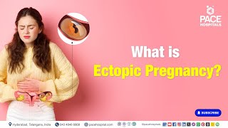 Ectopic Pregnancy Surgery  What is Ectopic Pregnancy  ectopicpregnancy [upl. by Mcfarland]