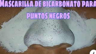 DILE ADIÓS A LOS PUNTOS NEGROS DE LA NARIZ CON BICARBONATO [upl. by Iolanthe593]