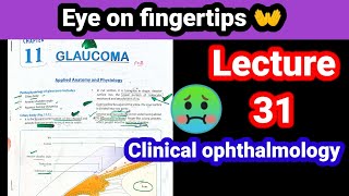 primary open angle glaucoma eye lectures 31 [upl. by Eliezer]