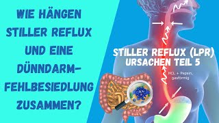 Wie hängen Stiller Reflux und eine Dünndarmfehlbesiedlung zusammen [upl. by Rojam231]