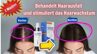 Trichomist Forte Haarausfallbehandlung Ist es gut Anwendung Preis wo kaufen [upl. by Kesia407]