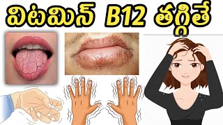 Low Vitamin B12 Symptoms in Teluguవిటమిన్ బి 12 [upl. by Idnim203]