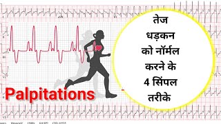 How to stop palpitations without medicine I Palpitation को बिना दवाई के तुरंत कैसे ठीक करे Hindi [upl. by Gherlein751]