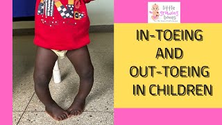 why childrens feet face funny directions [upl. by Inesita104]