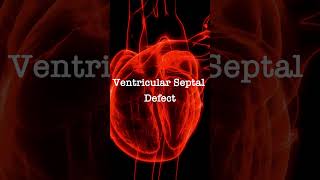 Normal Heart Sounds vs Ventricular Septal Defect Murmur [upl. by Marashio]