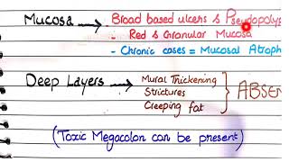 Ulcerative Colitis  Pathology [upl. by Knah]