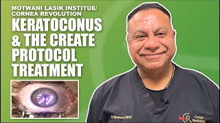 Keratoconus Treatment to Restore Vision Cornea Repair Epithelium and Topography Enhancement [upl. by Norina224]