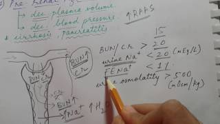 ACUTE KIDNEY INJURY  Prerenal Intrinsic renal and Postrenal azotemia  USMLE STEP 1 [upl. by Jemy]