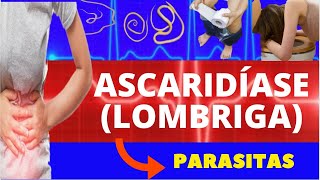 ASCARIDÍASE LOMBRIGA  CICLO DE VIDA SINTOMAS DIAGNÓSTICO E TRATAMENTO  PARASITOLOGIA [upl. by Shirlene768]